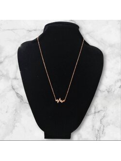 สร้อยสแตนเลส