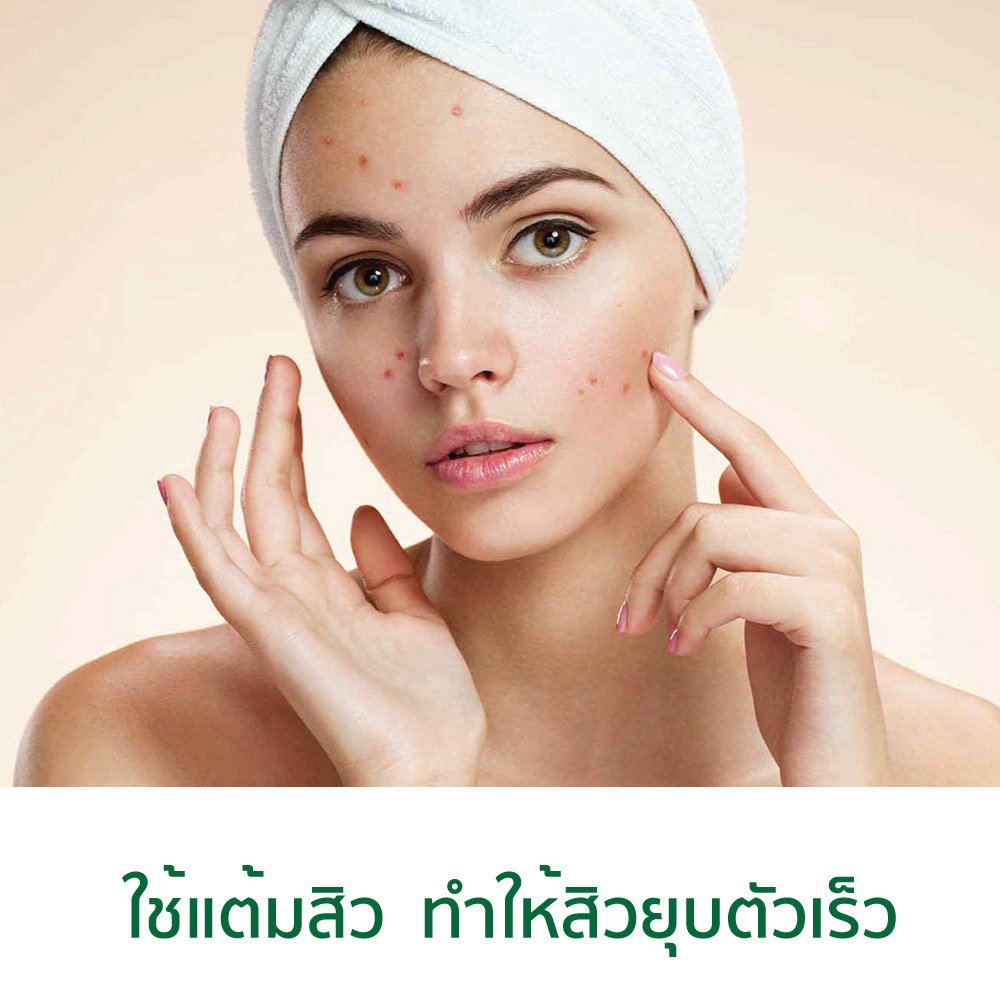 ที ทรี ออยล์ ยี่ห้อไหนดี ซื้อที่ไหน น้ำมัน ลด รอย สิว เป็นหวัดเจ็บคอ ราคา 290 ชมภิญญ์ (Chommpinn Tea Tree Oil ) 10 ml.