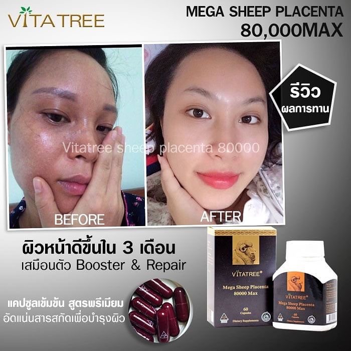 Vitatree รกแกะเม็ดเข้มข้น 80000mg คนไหนมีปัญหาผิว ฝ้ากระ สิว จุดด่างดำจัดไป บรรจุ 60 เม็ด