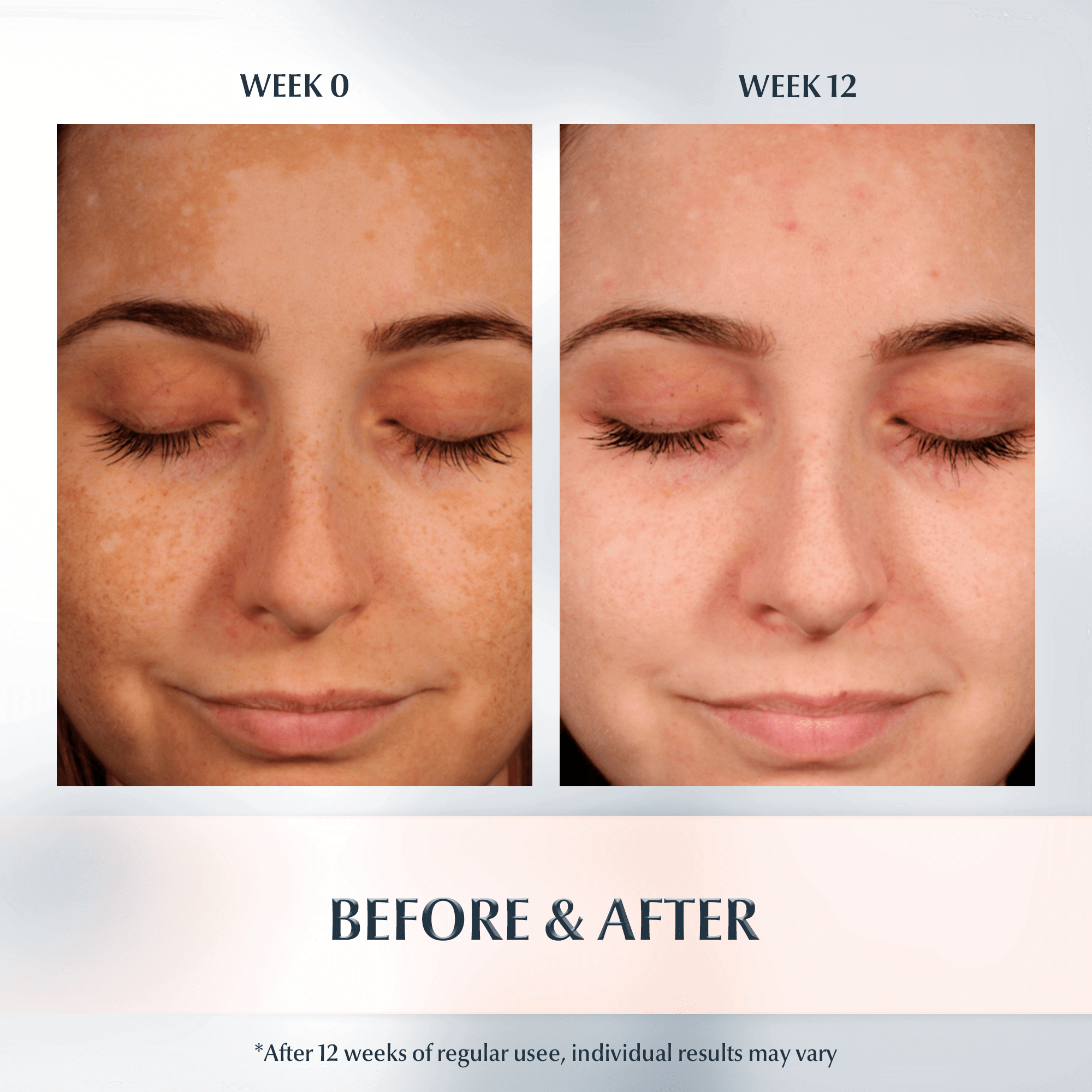 เซรั่มบำรุงผิวหน้ายูเซอริน Eucerin Anti Pigment Dual Serum 30ml