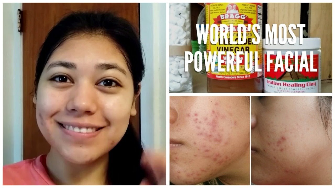 Sale ! Aztec Secret Indian Healing Clay ดีไหม ราคา 259 EXP : 03/2020 วิธีใช้ ซื้อที่ไหน? พร้อมส่ง มาร์คหน้า ใส 1 lb (454 g)