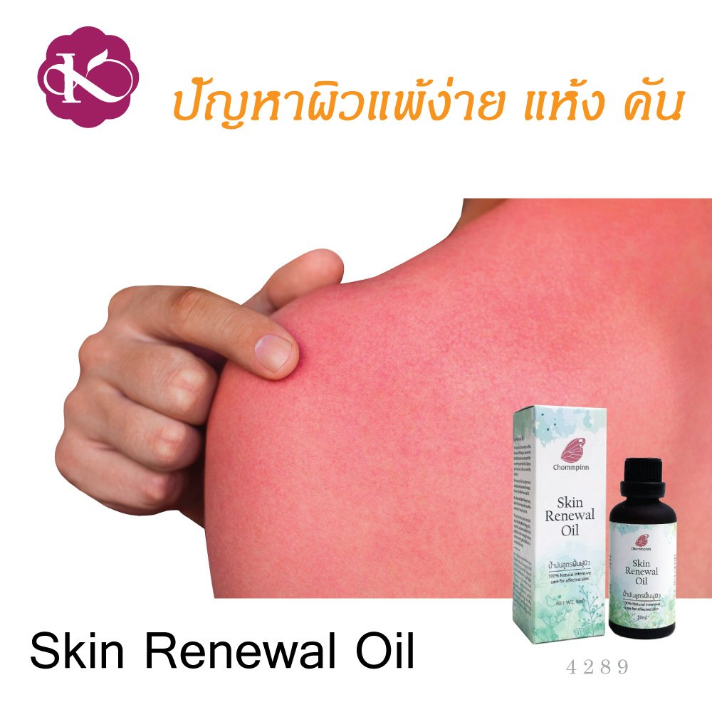 ผิวแห้งมาก ใช้อะไรดี น้ํามันบํารุงผิวยี่ห้อไหนดี น้ำมันบํารุงผิวกาย สกินแคร์ วีแกน ผิวแพ้ง่าย เป็นผื่นคัน ผิวแตกลาย ลดรอยแผลเป็น ออยทาผิว Skin Renewal Oil 50 ml. ผิวแพ้ง่ายใช้อะไรดี vegan skin care