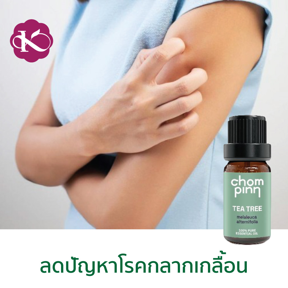 ที ทรี ออยล์ ยี่ห้อไหนดี ซื้อที่ไหน น้ำมัน ลด รอย สิว เป็นหวัดเจ็บคอ ราคา 290 ชมภิญญ์ (Chommpinn Tea Tree Oil ) 10 ml.