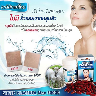 Healthway Sheep Placenta MAX 50000 mg. บรรจุ 100 เม็ด ใหม่ล่าสุด บำรุงผิวให้เนียนใสเด้งเด็ก