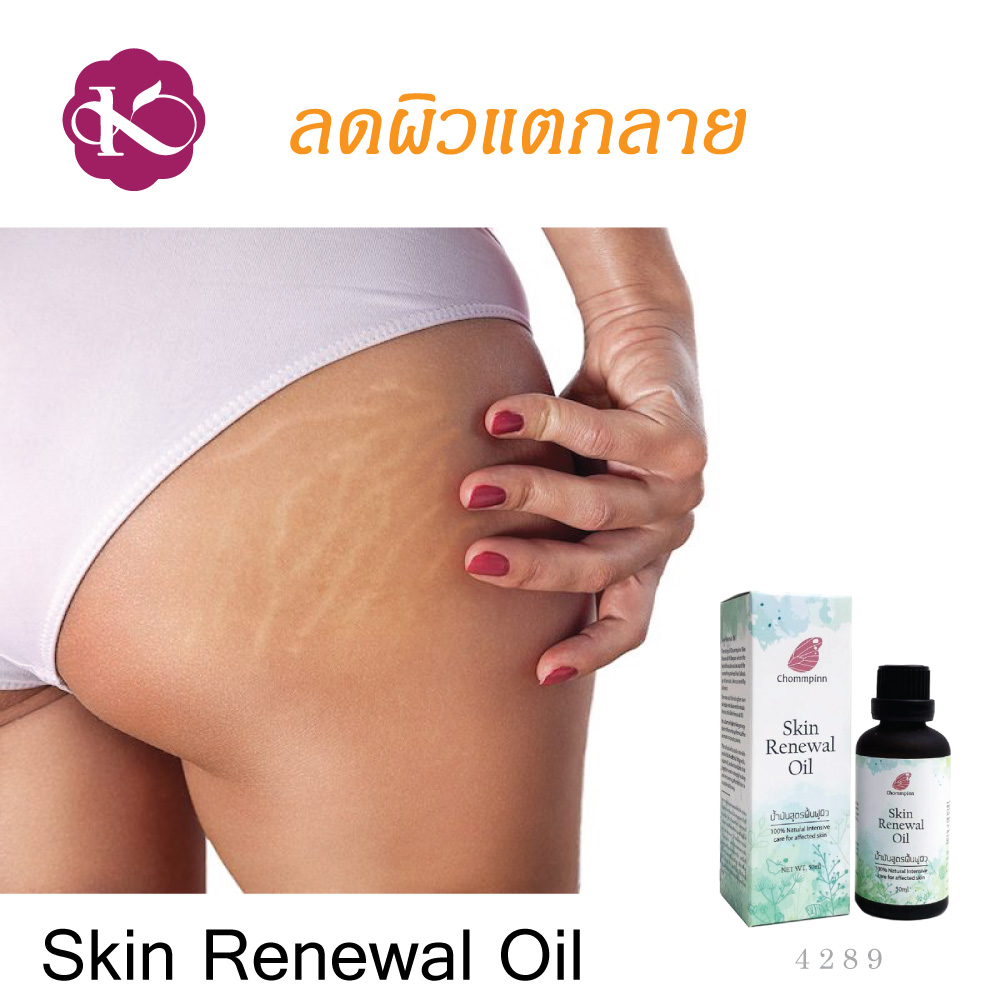 ผิวแห้งมาก ใช้อะไรดี น้ํามันบํารุงผิวยี่ห้อไหนดี น้ำมันบํารุงผิวกาย สกินแคร์ วีแกน ผิวแพ้ง่าย เป็นผื่นคัน ผิวแตกลาย ลดรอยแผลเป็น ออยทาผิว Skin Renewal Oil 50 ml. ผิวแพ้ง่ายใช้อะไรดี vegan skin care