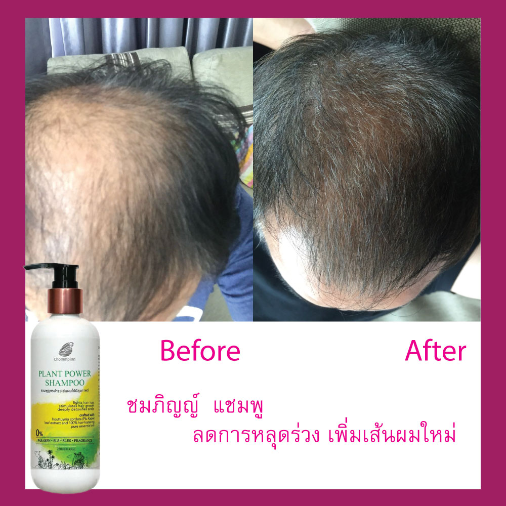 ผมบางมาก ใช้อะไรดี แชมพูผมดก ผมหนา สร้างผมใหม่ ชมภิญญ์ สมุนไพร ยาสระผม ลดผมร่วง ผมบาง Plant Power 250 ml. 2 ขวด