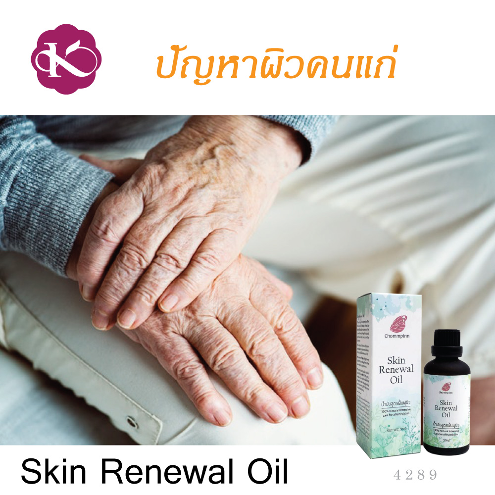 ผิวแห้งมาก ใช้อะไรดี น้ํามันบํารุงผิวยี่ห้อไหนดี น้ำมันบํารุงผิวกาย สกินแคร์ วีแกน ผิวแพ้ง่าย เป็นผื่นคัน ผิวแตกลาย ลดรอยแผลเป็น ออยทาผิว Skin Renewal Oil 50 ml. ผิวแพ้ง่ายใช้อะไรดี vegan skin care