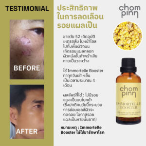 12.12 Sale 1,467 น้ํามันบํารุงผิวหน้ายี่ห้อไหนดี ชมภิญญ์ อิมมอร์แตล บูทส์เตอร์ ออยบํารุงหน้า สกินแคร์ วีแกน บอกลา หน้าแก่ก่อนวัย หน้าใส หน้าเด็ก เซรั่มลดริ้วรอย Immortelle Booster 20 ml. หน้าแห้งทำไงดี วิธีธรรมชาติ vegan skin care