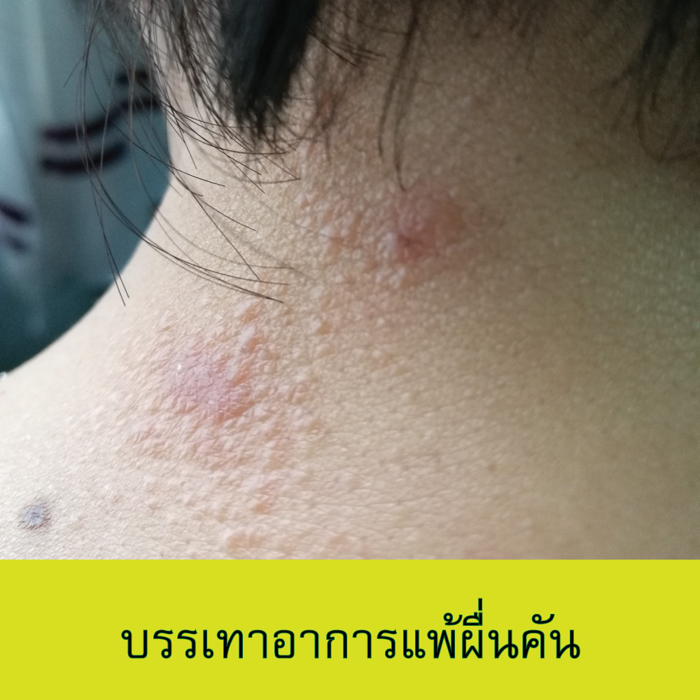 น้ำมันมะรุม สกัดเย็น ยี่ห้อไหนดีสุด Moringa ชมภิญญ์ 50 ml. เกรดพรีเมี่ยม ดียังไง ราคา...